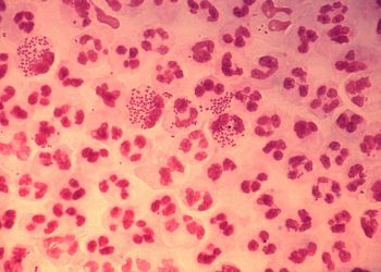 Gonorrea resistente: nuovi test e due terapie cambiano le cure