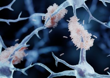 Cina vieta la chirurgia sperimentale contro l'Alzheimer