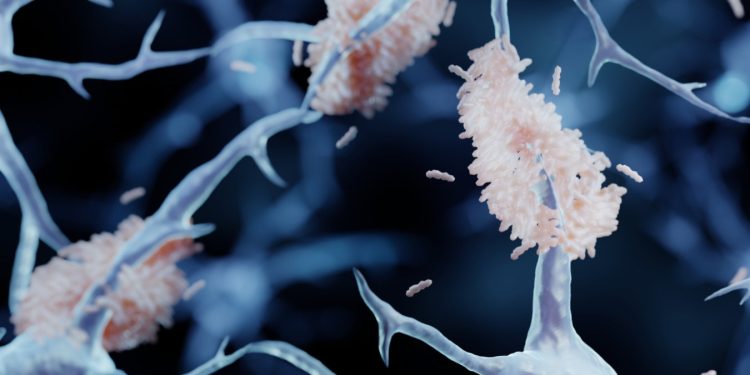 Cina vieta la chirurgia sperimentale contro l'Alzheimer