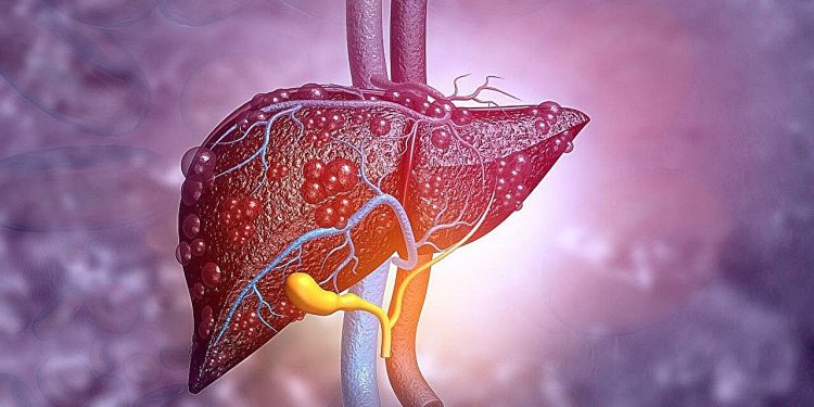 Fibrosi epatica e rischio cardiovascolare: il ruolo della glicemia