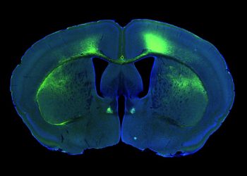 A Basilea scoperti i neuroni che ci fanno venire sonno