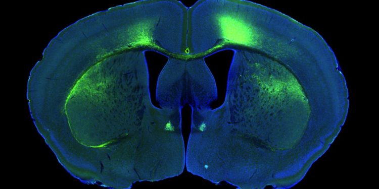 A Basilea scoperti i neuroni che ci fanno venire sonno