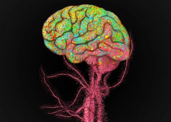 Cervello che invecchia, cellule immunitarie lo invadono